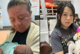 Madre Sufre Deformación Facial por Embarazo: Consecuencias y Superación