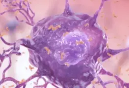 Cuidadores Familiares El Reto del Alzheimer