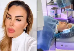 Cantante Ninel Conde muestra satisfacción tras cirugía de ojos