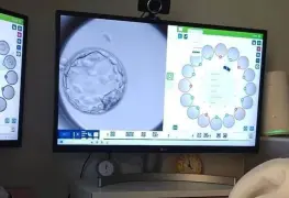 Innovador tratamiento logra embarazo con esperma recuperado en paciente con azoospermia