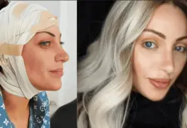 Muere la Barbie Humana tras 27 cirug&iacute;as