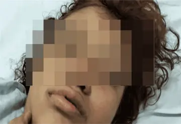 Hombre en estado crítico necesita identificación en Centla