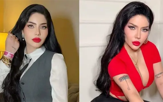 Pol&eacute;mica por cirug&iacute;a est&eacute;tica a hija de influencer