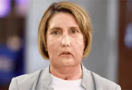 Primer trasplante de rostro con donante que eligi&oacute; la eutanasia