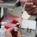 Autoridades confirman aumento de casos de sarampi&oacute;n en Jalisco