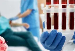 Sensor &oacute;ptico revoluciona detecci&oacute;n temprana de c&aacute;ncer en sangre