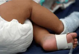 Muere beb&eacute; por sarampi&oacute;n en Guerrero
