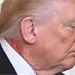 Donald Trump y su tratamiento para la erupci&oacute;n en el cuello