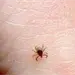 Alerta en Ciudad Ju&aacute;rez por aumento de casos de rickettsiosis