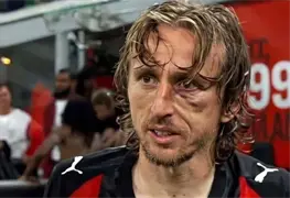 Luka Modric se fractura el p&oacute;mulo y pasar&aacute; por quir&oacute;fano antes del Mundial 2026