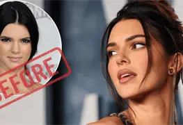 Kendall Jenner asegura ser naturalita