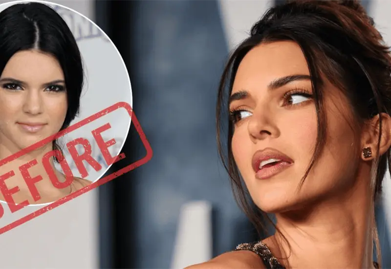 Kendall Jenner asegura ser naturalita