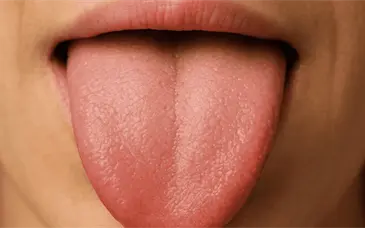 &iquest;Qu&eacute; dice el color de tu lengua sobre tu salud?